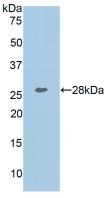 Polyclonal Antibody to Collagen Type I Alpha 1 (COL1a1)