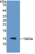 Polyclonal Antibody to Protein Kinase Inhibitor Alpha (PKIa)