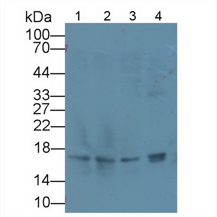 Polyclonal Antibody to Copeptin (CPP)