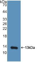 Polyclonal Antibody to Interferon Gamma Induced Protein 10kDa (IP10)