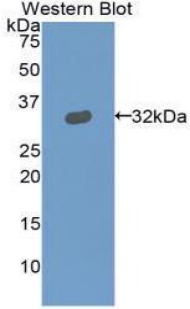 Polyclonal Antibody to Gelsolin (GSN)