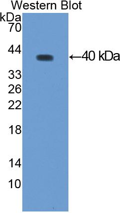 Polyclonal Antibody to Gelsolin (GSN)