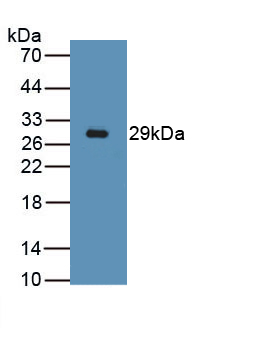 Polyclonal Antibody to Desmin (Des)