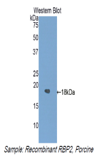 Polyclonal Antibody to Retinol Binding Protein 2, Cellular (RBP2)