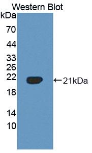 Polyclonal Antibody to Vasoactive Intestinal Peptide (VIP)