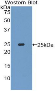 Polyclonal Antibody to Interleukin 27A (IL27A)