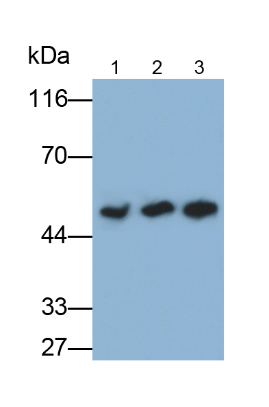 Polyclonal Antibody to Lipoprotein lipase (LPL)