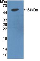 Polyclonal Antibody to Lipoprotein lipase (LPL)