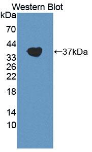 Polyclonal Antibody to Complement Component 3a (C3a)