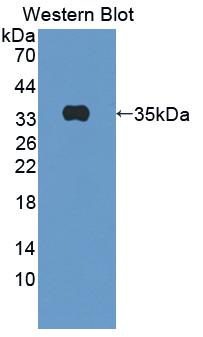 Polyclonal Antibody to Complement Component 5a (C5a)