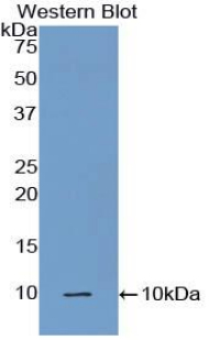 Polyclonal Antibody to Complement Component 5a (C5a)