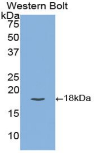 Polyclonal Antibody to Tissue Factor Pathway Inhibitor (TFPI)