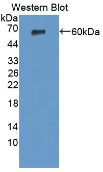 Polyclonal Antibody to Tissue Factor Pathway Inhibitor (TFPI)