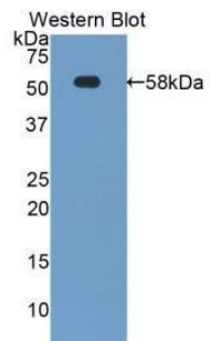 Polyclonal Antibody to Tissue Factor Pathway Inhibitor (TFPI)