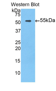 Polyclonal Antibody to Tissue Factor Pathway Inhibitor (TFPI)