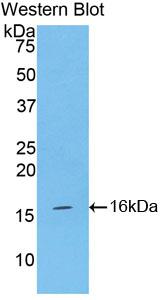 Polyclonal Antibody to Inhibin Alpha (INHa)