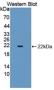 Polyclonal Antibody to Sex Hormone Binding Globulin (SHBG)