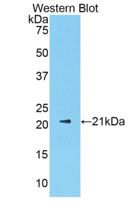 Polyclonal Antibody to Sex Hormone Binding Globulin (SHBG)