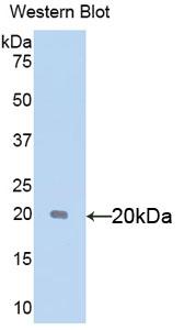 Polyclonal Antibody to Sex Hormone Binding Globulin (SHBG)