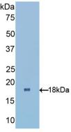 Polyclonal Antibody to Retinol Binding Protein 1, Cellular (RBP1)