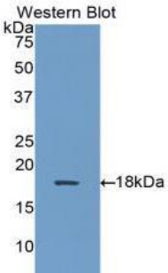 Polyclonal Antibody to Alpha-Hemoglobin Stabilizing Protein (aHSP)