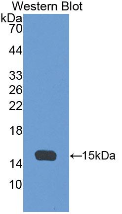 Polyclonal Antibody to Alpha-Hemoglobin Stabilizing Protein (aHSP)