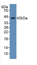 Polyclonal Antibody to Alpha-Hemoglobin Stabilizing Protein (aHSP)