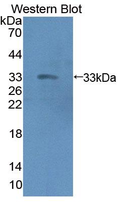 Polyclonal Antibody to Elastin Microfibril Interface Located Protein 1 (EMILIN1)