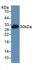 Polyclonal Antibody to Elastin Microfibril Interface Located Protein 1 (EMILIN1)