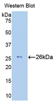 Polyclonal Antibody to Granzyme M (GZMM)