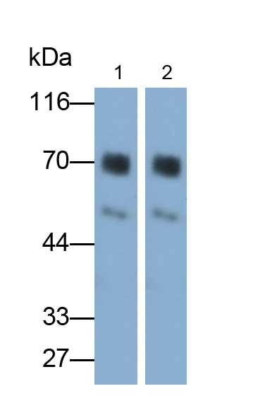 PAA435Hu01.jpg