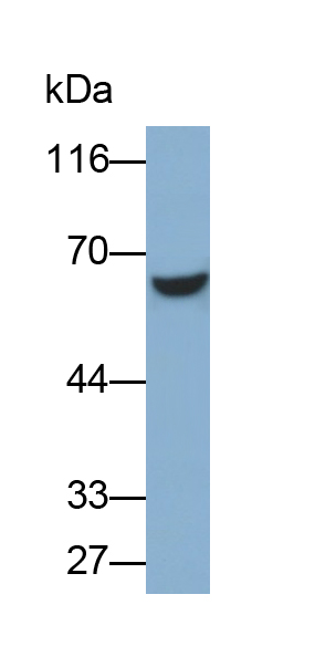 Polyclonal Antibody to Estrogen Receptor Beta (ERb)