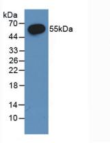 Polyclonal Antibody to Estrogen Receptor Beta (ERb)