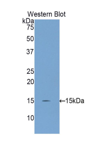 Polyclonal Antibody to Inhibin Beta C (INHbC)