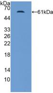 Polyclonal Antibody to Mineralocorticoid Receptor (MR)