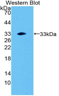 Polyclonal Antibody to Lipase, Endothelial (LIPG)