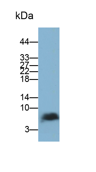 Polyclonal Antibody to Osteocalcin (OC)