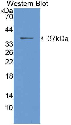 Biotin-Linked Polyclonal Antibody to Calcitonin (CT)