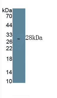 Polyclonal Antibody to Xeroderma Pigmentosum, Complementation Group C (XPC)