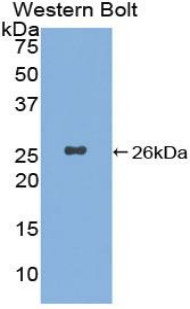 Polyclonal Antibody to Xeroderma Pigmentosum, Complementation Group C (XPC)