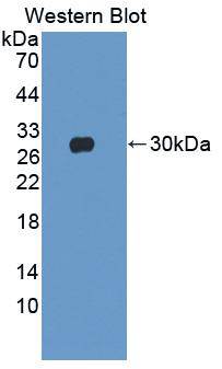 Polyclonal Antibody to Cardiac Troponin I (cTnI)