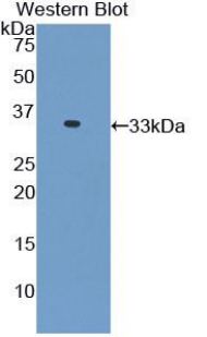 Polyclonal Antibody to Cardiac Troponin I (cTnI)