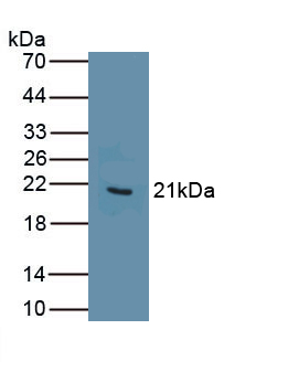 Polyclonal Antibody to Myoglobin (MYO)