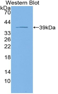 Polyclonal Antibody to Cytokeratin 4 (CK4)