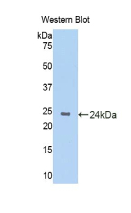 Polyclonal Antibody to Cytokeratin 4 (CK4)