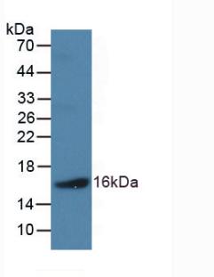 Polyclonal Antibody to Natriuretic Peptide Precursor B (NPPB)