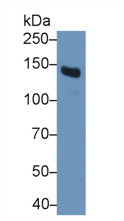 Polyclonal Antibody to D-Dimer (D2D)