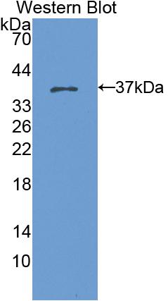 Polyclonal Antibody to Cytokeratin 15 (CK15)