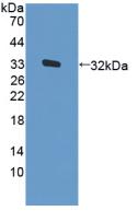 Polyclonal Antibody to Protein Kinase R (PKR)