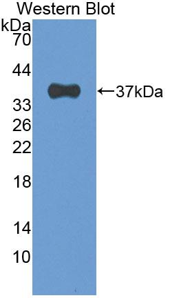 Polyclonal Antibody to Protein Kinase R (PKR)